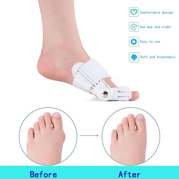 🔥Begrenzte Stückzahl, 40 % Rabatt, solange der Vorrat reicht!👟 Hallux-Valgus-Korrektur für Männer und Frauen